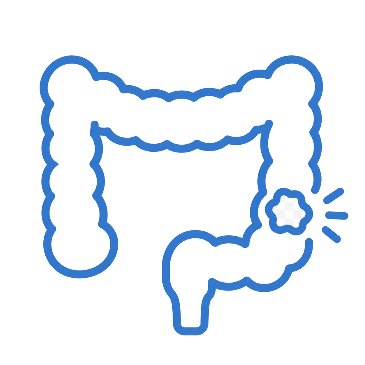 大腸カメラ（下部消化管内視鏡検査）