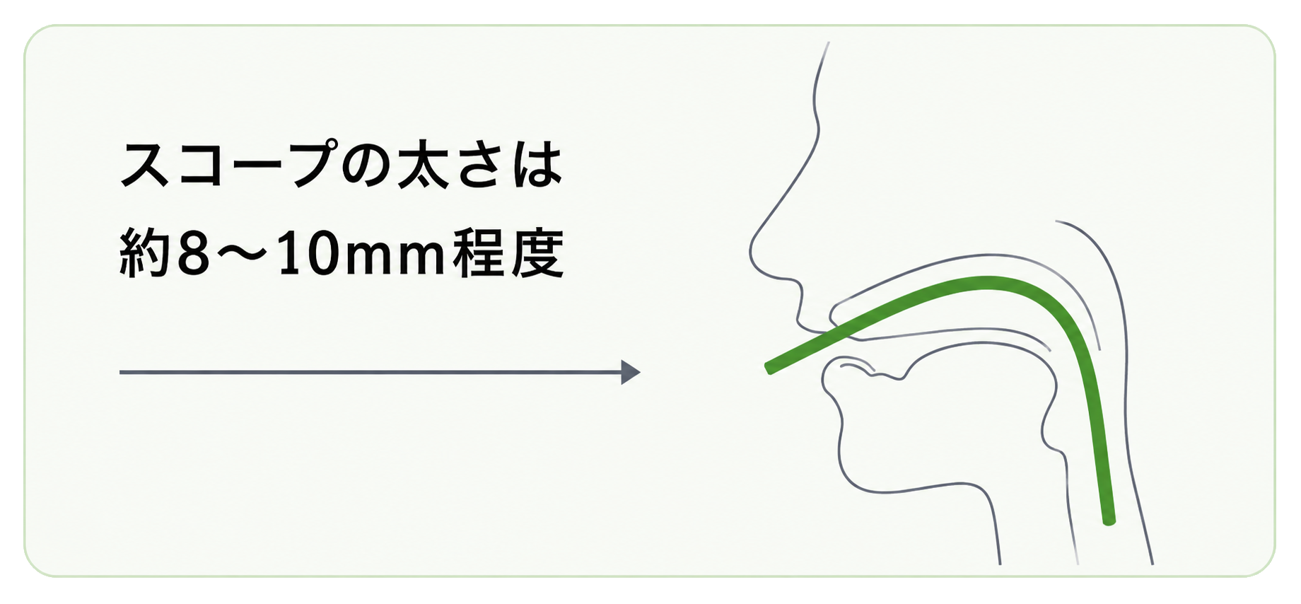 口から挿入する内視鏡スコープの太さの説明イメージ