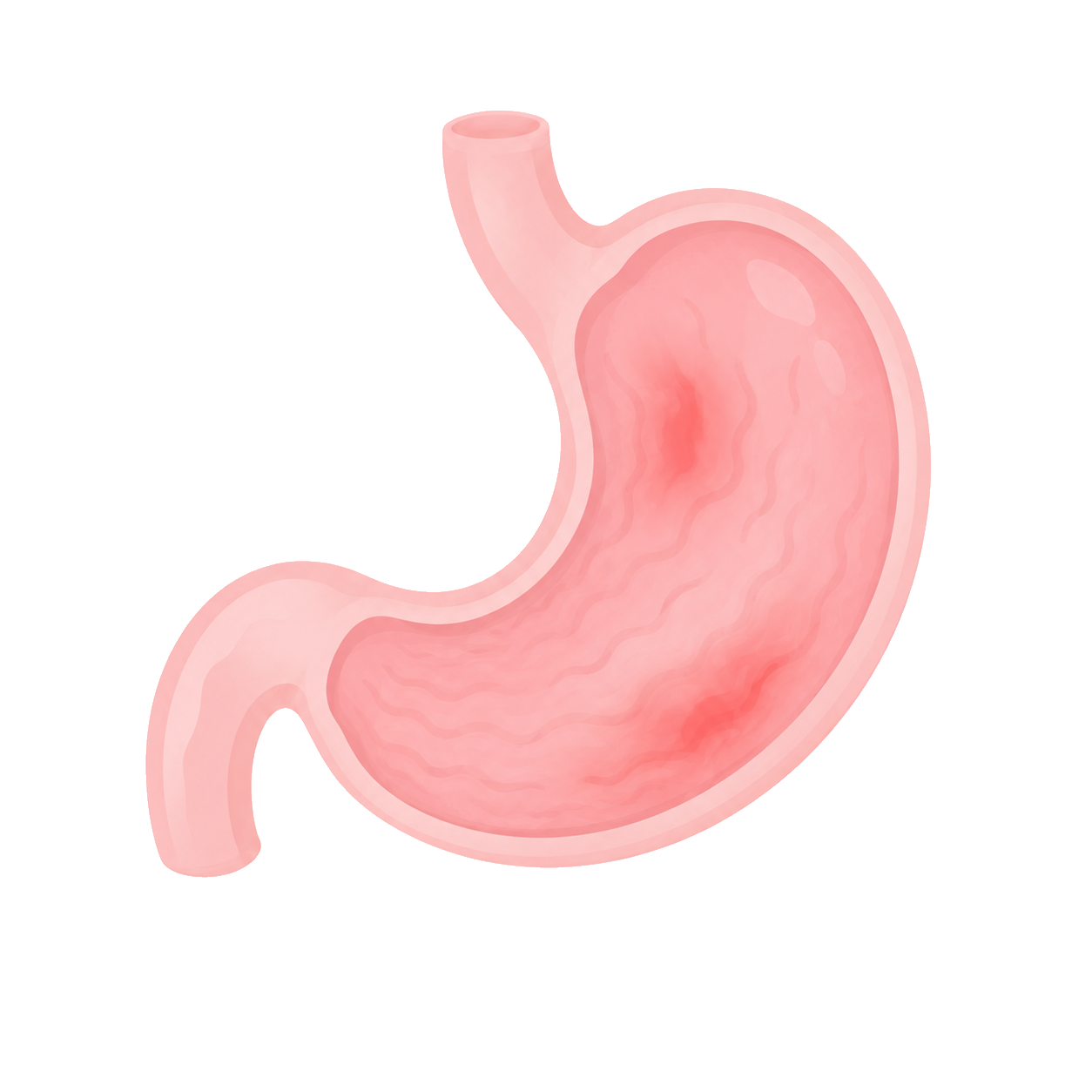 胃の病気のイラスト