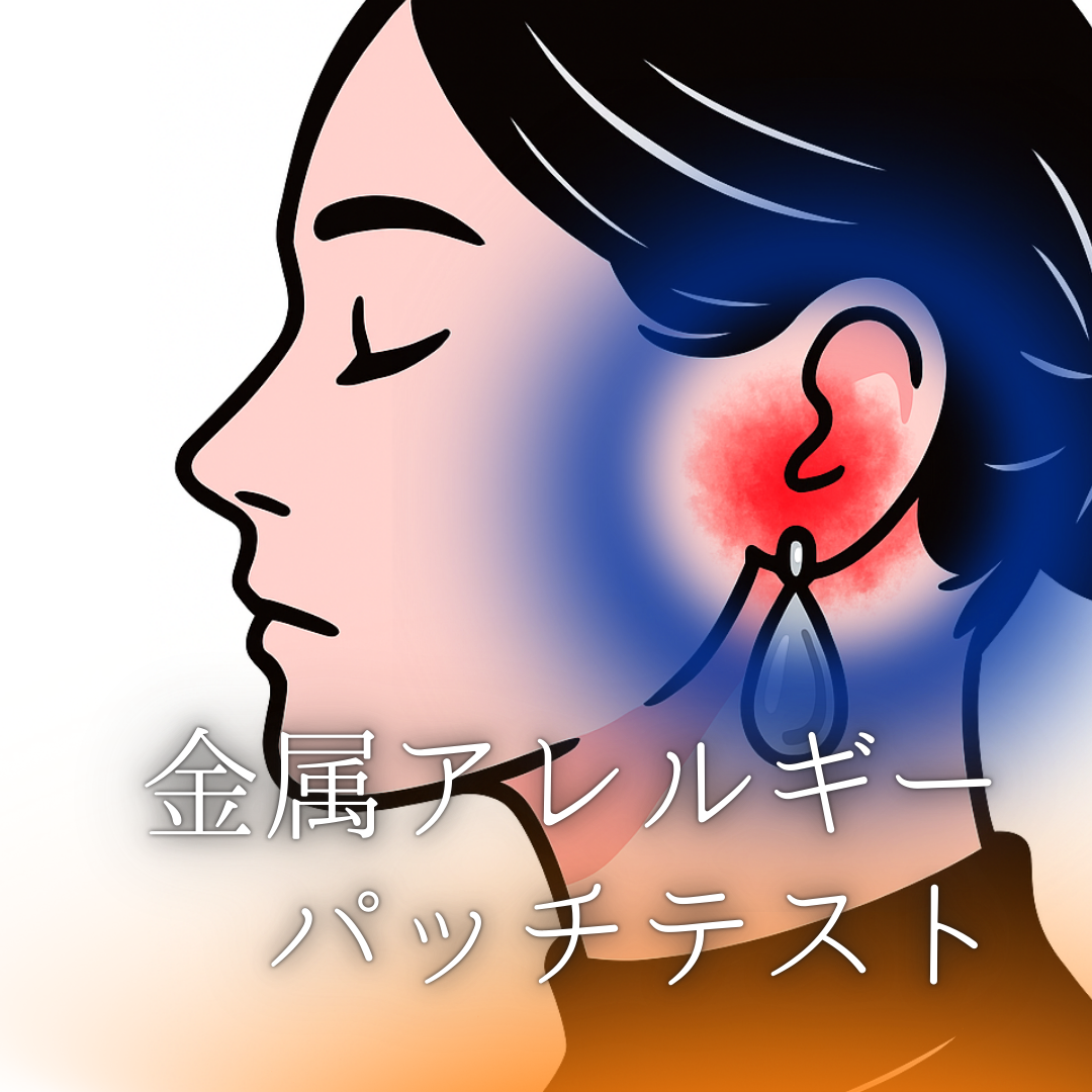 金属アレルギーの症状と原因金属の調べ方｜パッチテスト