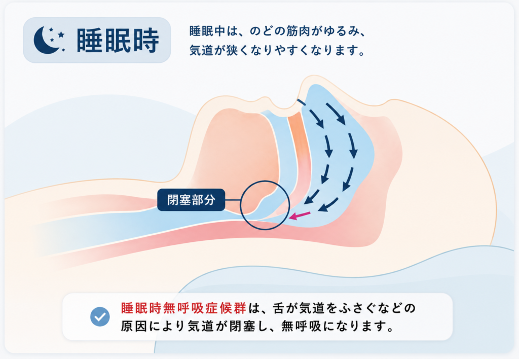睡眠時無呼吸症候群は舌が気道をふさぐなどの原因により気道が閉塞し無呼吸になります|下山記念クリニック(東広島)