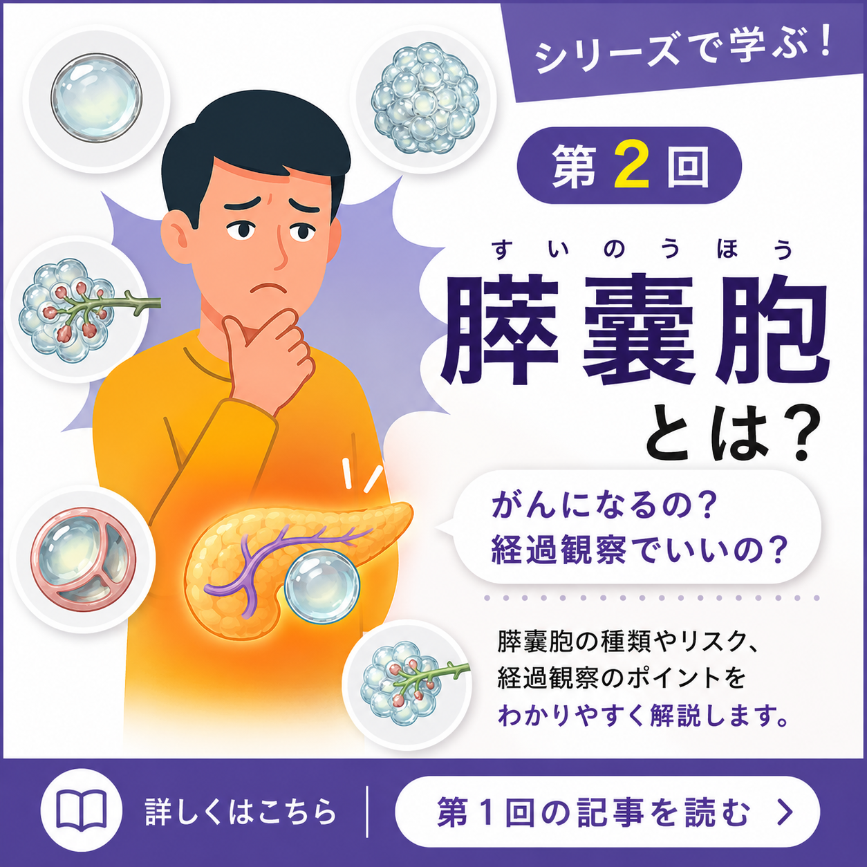 【第2回】膵嚢胞は放置して大丈夫か 見逃してはいけないポイントと検査・経過観察の目安を専門医が解説