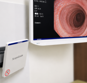 鎮静剤とスコープガイドを活用した大腸カメラ検査