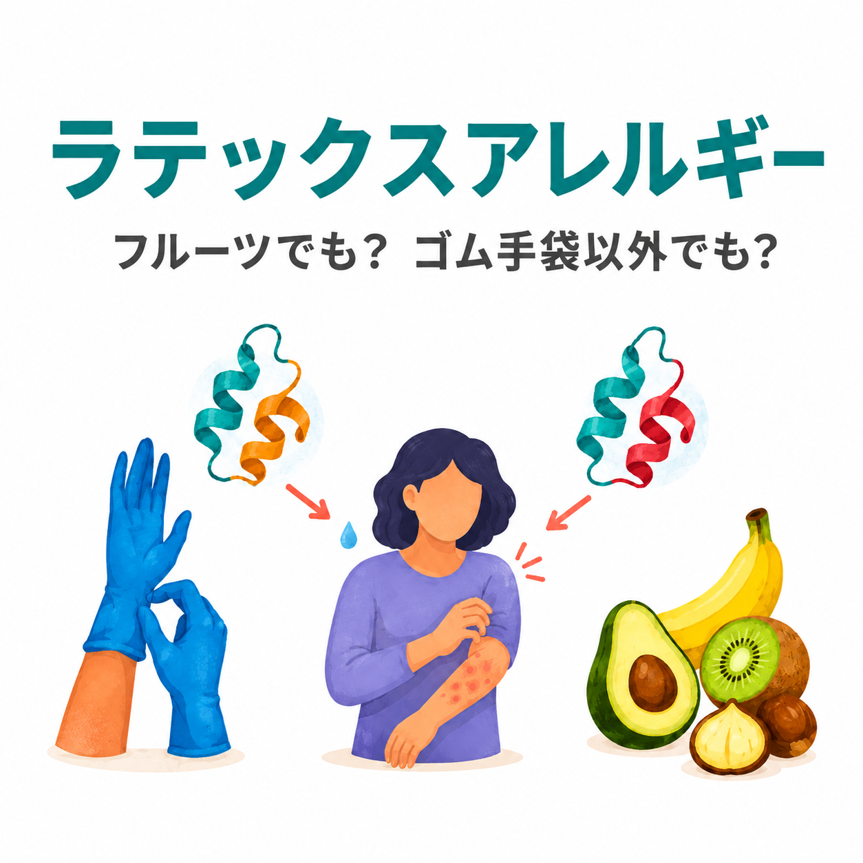 ラテックスアレルギーとは？バナナ・アボカドとの関係